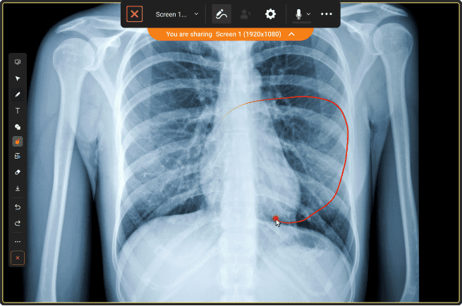 Discussion of an X-ray image using TrueConf collaboration tools